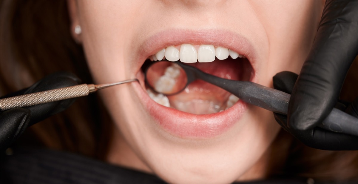 Tratamentos de Periodontia